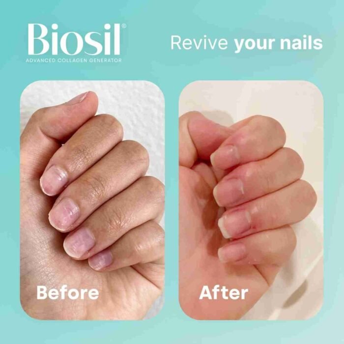 Biosil Collagen Generator – 120 Original Capsules – with Patented ch-OSA Complex – Generates & Protects Your Own Collagen – GMO | Choice Wholesales