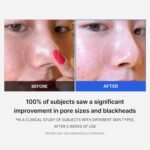 Medicube Deep Vita C Facial Pads, Vitamin C Toner Pads for Uneven Skin Tone | Choice Wholesales