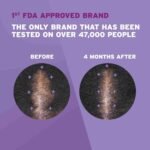 Rogaine 5% Minoxidil Foam, Topical Once-A-Day Hair Loss Treatment for Women to Regrow Fuller | Choice Wholesales
