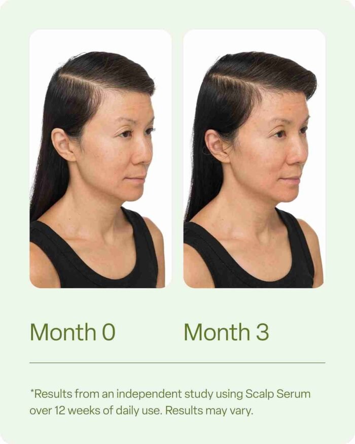 Divi Scalp Serum for Thinning Hair, 30ml – Clinically Tested, Nourishing Formula with Amino Acids, Caffeine & Rosemary Oil – | Choice Wholesales