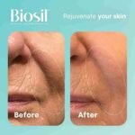 Biosil Collagen Generator – 120 Original Capsules – with Patented ch-OSA Complex – Generates & Protects Your Own Collagen – GMO | Choice Wholesales