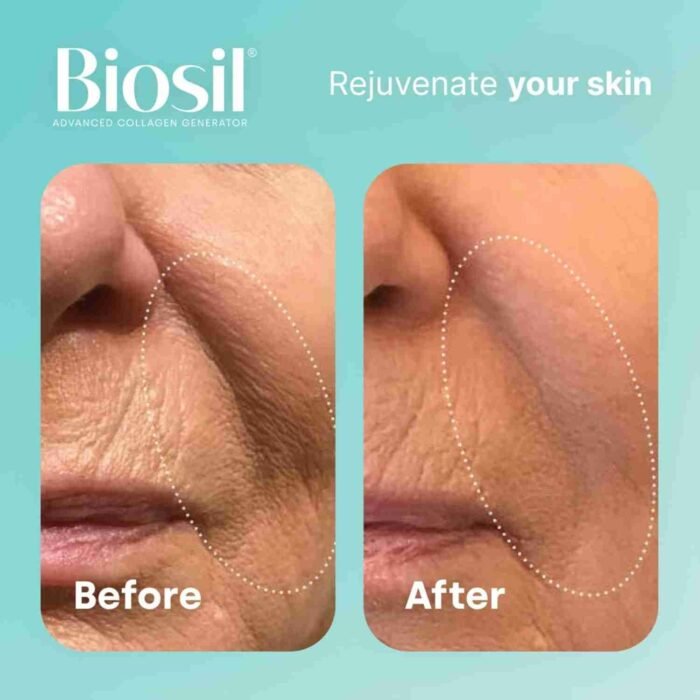 Biosil Collagen Generator – 120 Original Capsules – with Patented ch-OSA Complex – Generates & Protects Your Own Collagen – GMO | Choice Wholesales