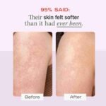 First Aid Beauty KP Bump Eraser Body Scrub Exfoliant for Keratosis Pilaris with 10% AHA – 8 oz | Choice Wholesales