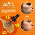 TruSkin Vitamin C Serum – Anti Aging Facial Serum with Vitamin C, Hyaluronic Acid, Vitamin E & More – Brightening Serum for | Choice Wholesales
