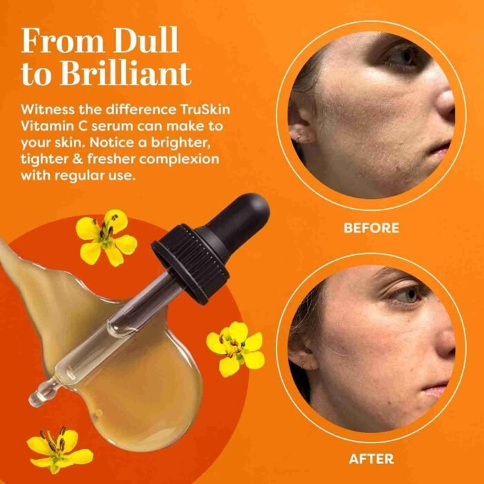 TruSkin Vitamin C Serum – Anti Aging Facial Serum with Vitamin C, Hyaluronic Acid, Vitamin E & More – Brightening Serum for | Choice Wholesales