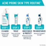 CeraVe Acne Face Wash, Acne Cleanser with Salicylic Acid and Purifying Clay for Oily Skin, 8 fl oz | Choice Wholesales