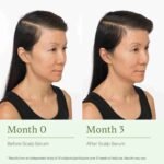 Divi Scalp Serum for Thinning Hair, 30ml – Clinically Tested, Nourishing Formula with Amino Acids, Caffeine & Rosemary Oil – | Choice Wholesales