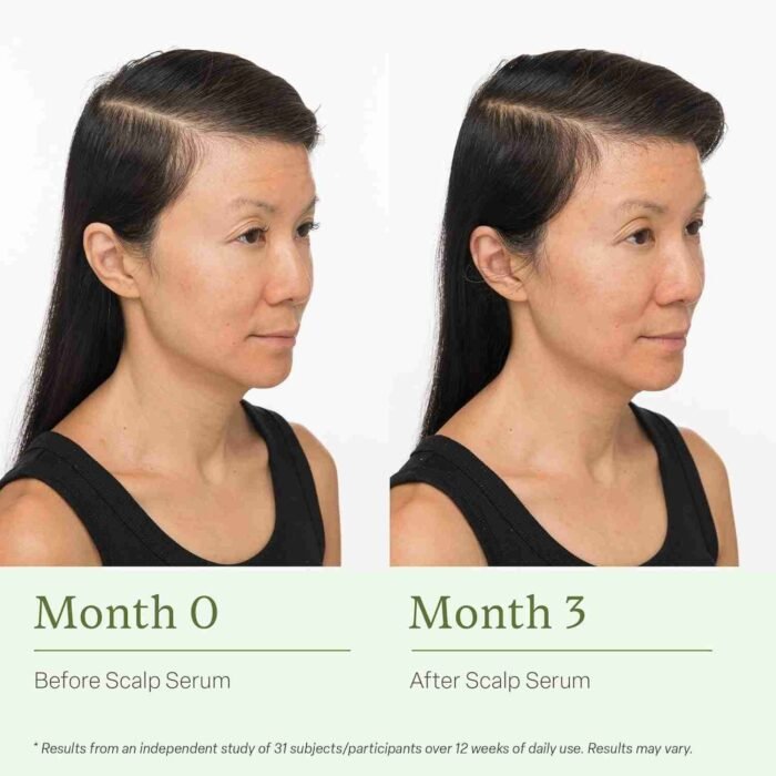 Divi Scalp Serum for Thinning Hair, 30ml – Clinically Tested, Nourishing Formula with Amino Acids, Caffeine & Rosemary Oil – | Choice Wholesales