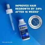 Men’s Rogaine Extra Strength 5% Minoxidil Topical Solution for Thin Hair, Hair Loss Treatment to Regrow Fuller, Thicker Hair, | Choice Wholesales